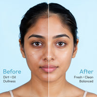 SLICK GL Anti-acne Foaming Facewash