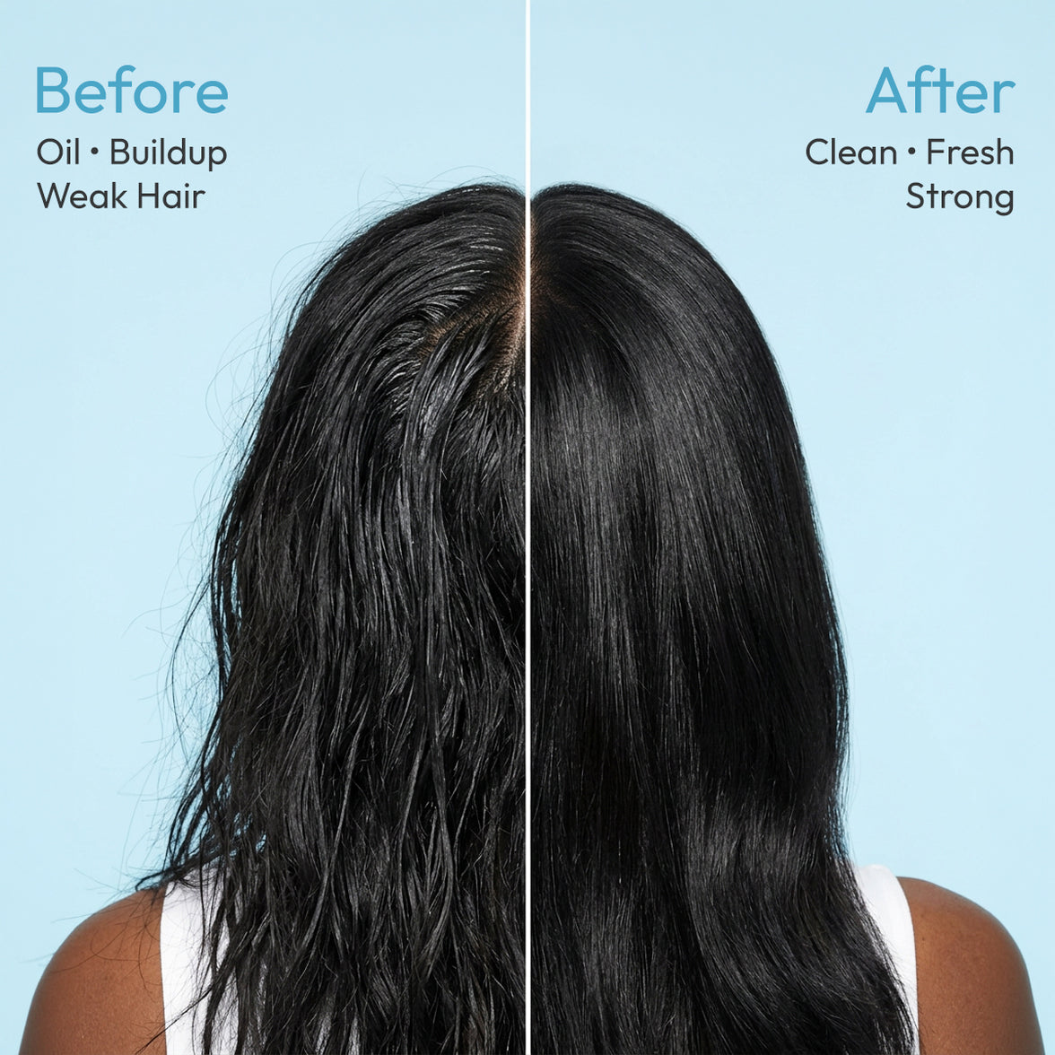 HI-GAIN Biotin Shampoo