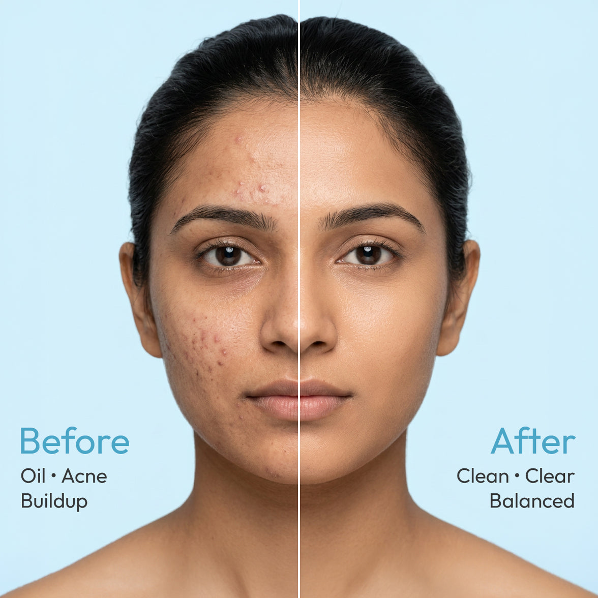 GLOWSOFT Anti-Acne Face Wash